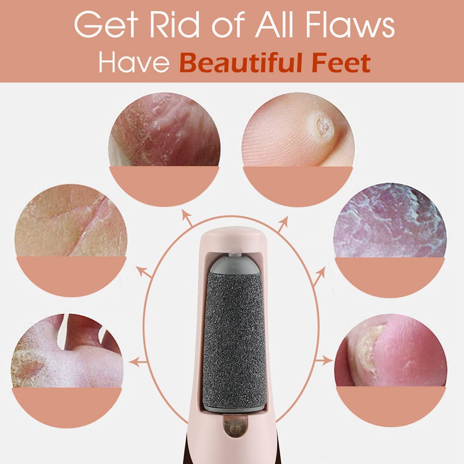 Callus Remover Rechargeable Pedicure Tool for Dead Skin |Foot Roller Callus Remover Hard and Dead Skin Remover |Feet Care Callus Remover | Pedicure for Hard Cracked Skin, Foot Scrubber Roller Callus Remover Rechargeable Pedicure Tool for Dead Skin |Foot Roller Callus Remover Hard and Dead Skin Remover |Feet Care Callus Remover | Pedicure for Hard Cracked Skin, Foot Scrubber Roller